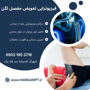 فیزیوتراپی بعد از جراحی تعویض مفصل لگن