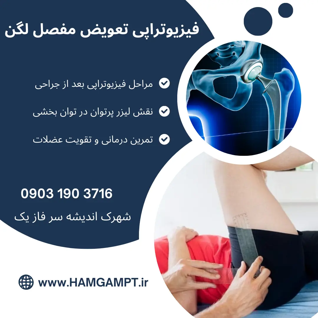 فیزیوتراپی بعد از جراحی تعویض مفصل لگن